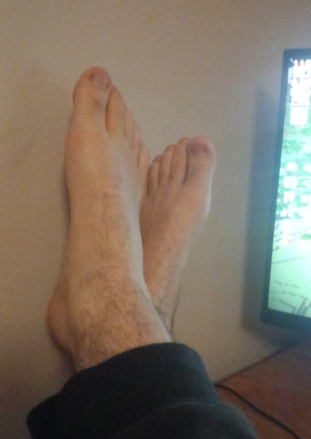 Analyse esthétique des pieds de Matthias en position de repos informatique